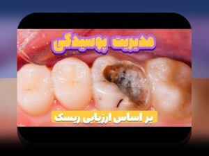 چرا تحلیل ریسک ساده زندگی مهم است؟ راهنمایی برای درک بهتر مفاهیم و کاربردهای آن